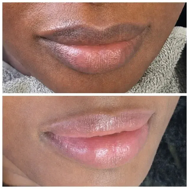 Lips before and after lip neutralisation on a client with deep skin