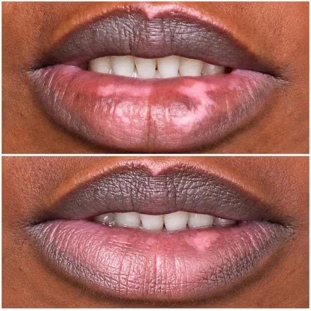 Lips before and after a lip camouflage session