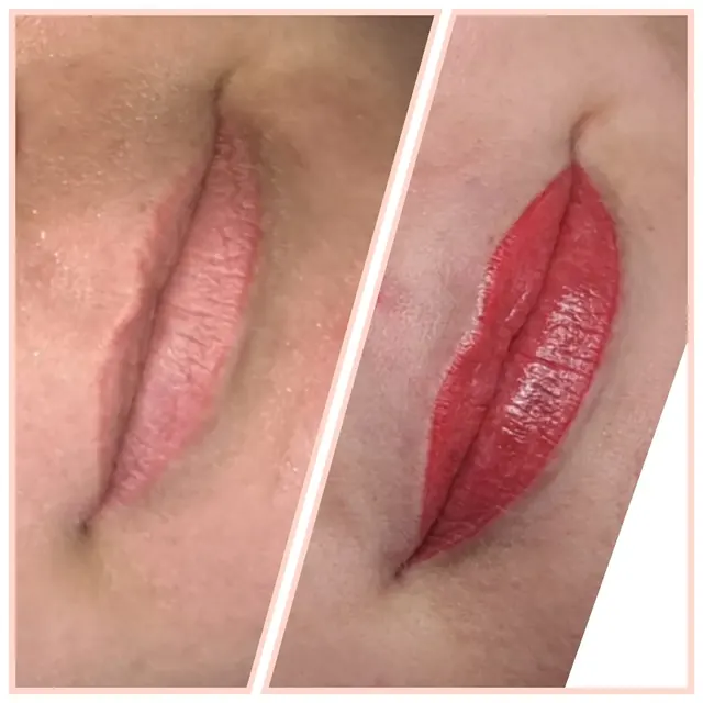 Lips before and after lip blush