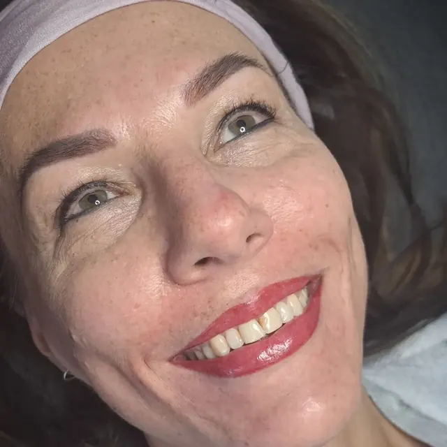 Smiling client with lip blush