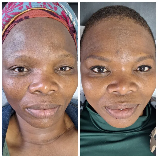 Before and after brows on a client with deep skin