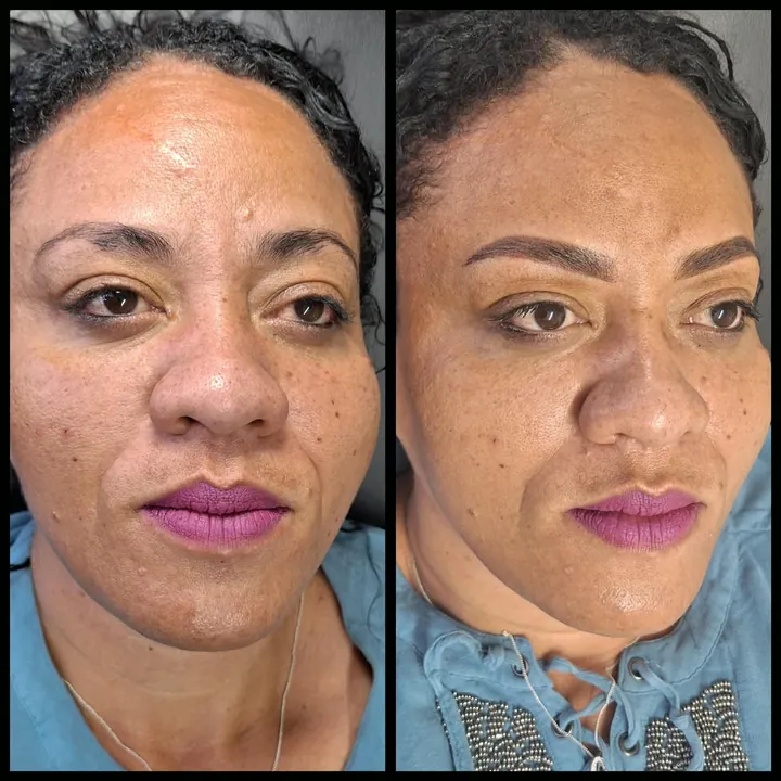 Before and after permanent brows by Tess PMU on a client with curly hair